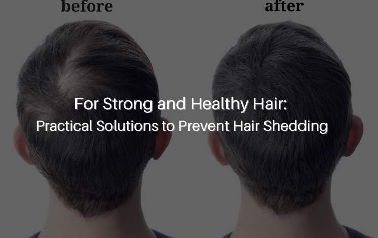 For Strong and Healthy Hair: Practical Solutions to Prevent Hair Shedding